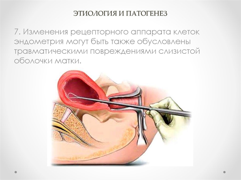 Кюретаж полости матки. Выскабливание полости матки инструментарий диагностическое. Выскабливание цервикального канала шейки. Диагностическое выскабливание слизистой матки это.