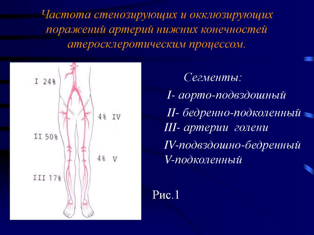 Магистральные артерии нижних конечностей