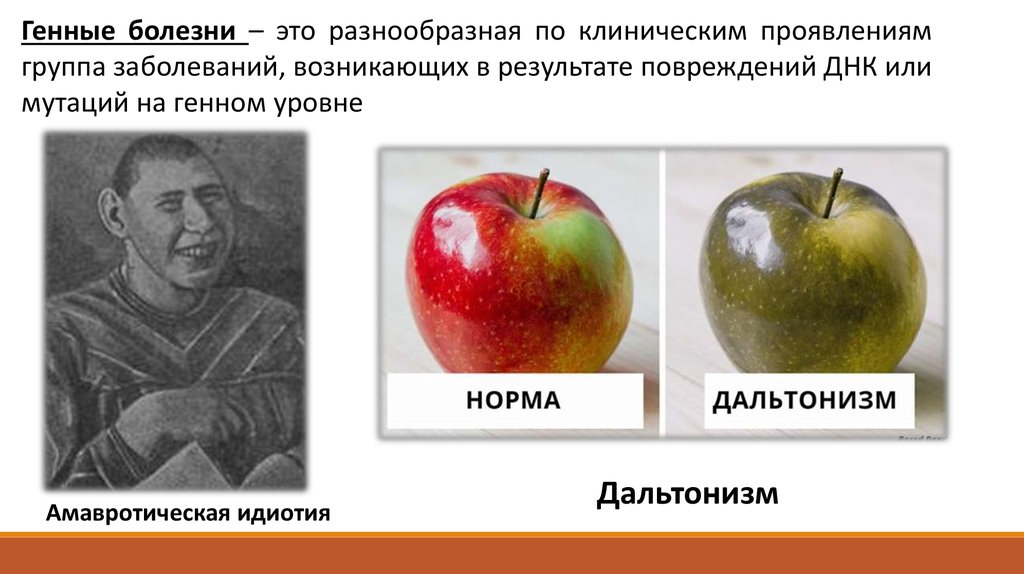 Лазарев с.н болезни ног