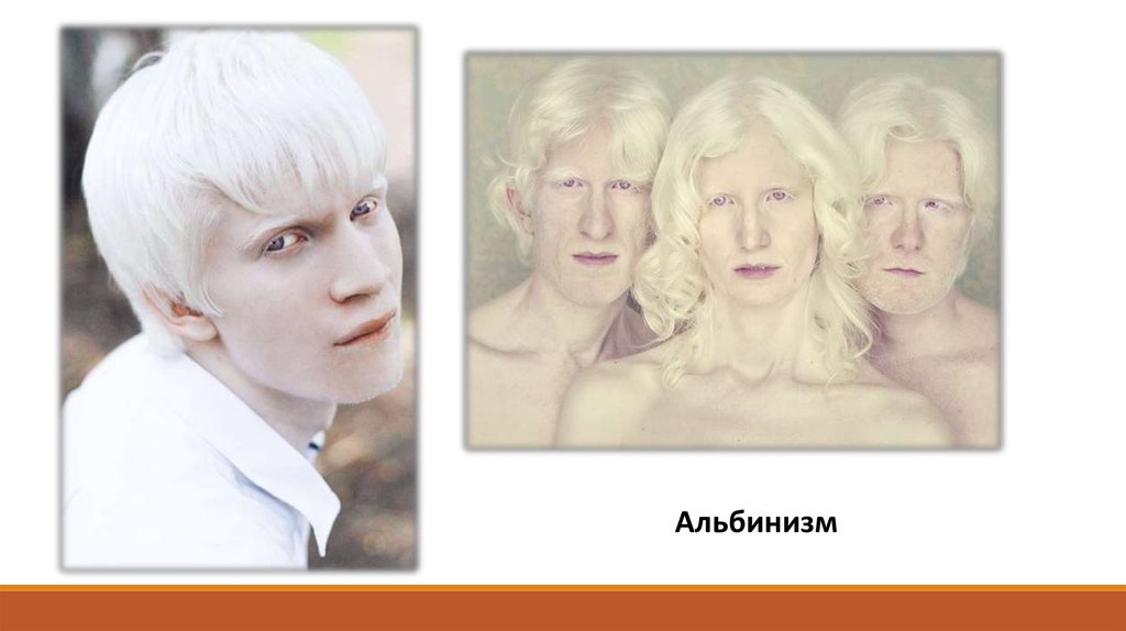 Всегда болит голова от компьютера