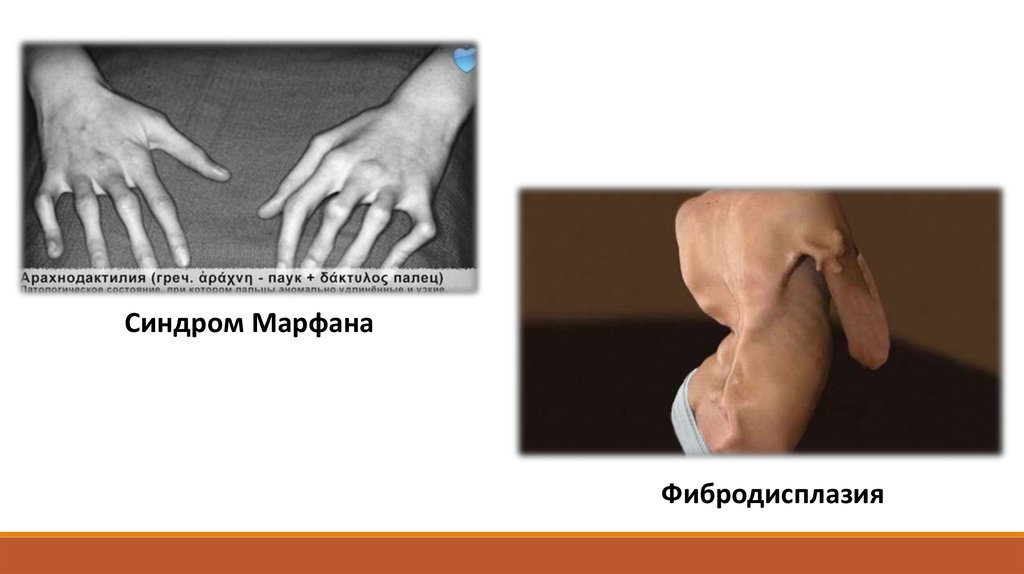 Болезни поясница