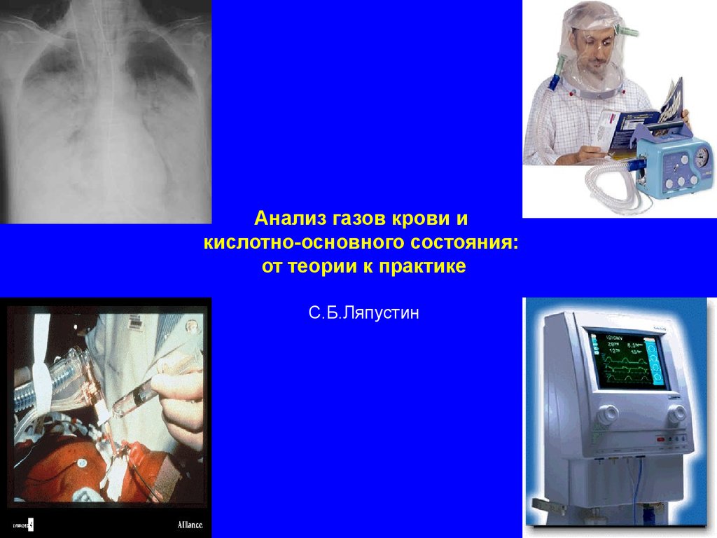 Исследование газов. Исследование газов крови. Исследованиегазов кров. Исследование кислотно-основного состояния крови. Методы исследования кислотно-основного состояния газов крови.