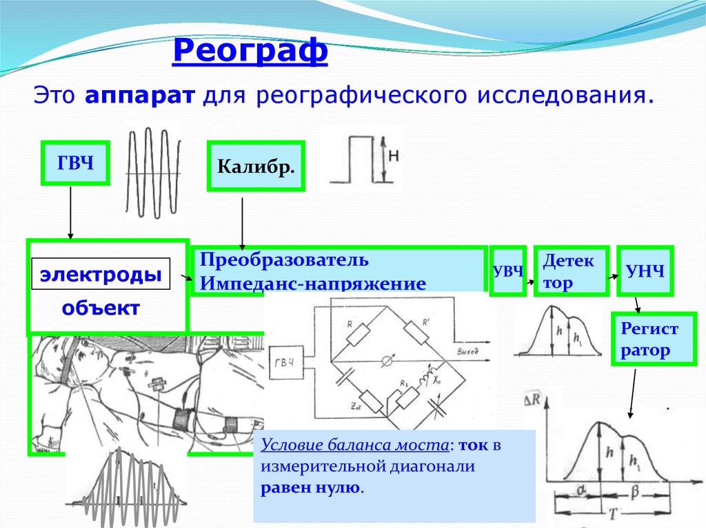 Блок схема реографа