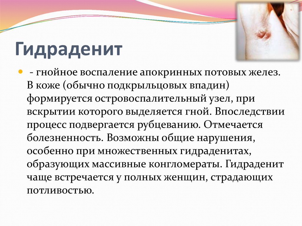 Воспаление наружных половых органов у женщин. Суппуративный гидраденит. Воспаление потовой железы - гидраденит. Воспаление потовых желез подмышкой.