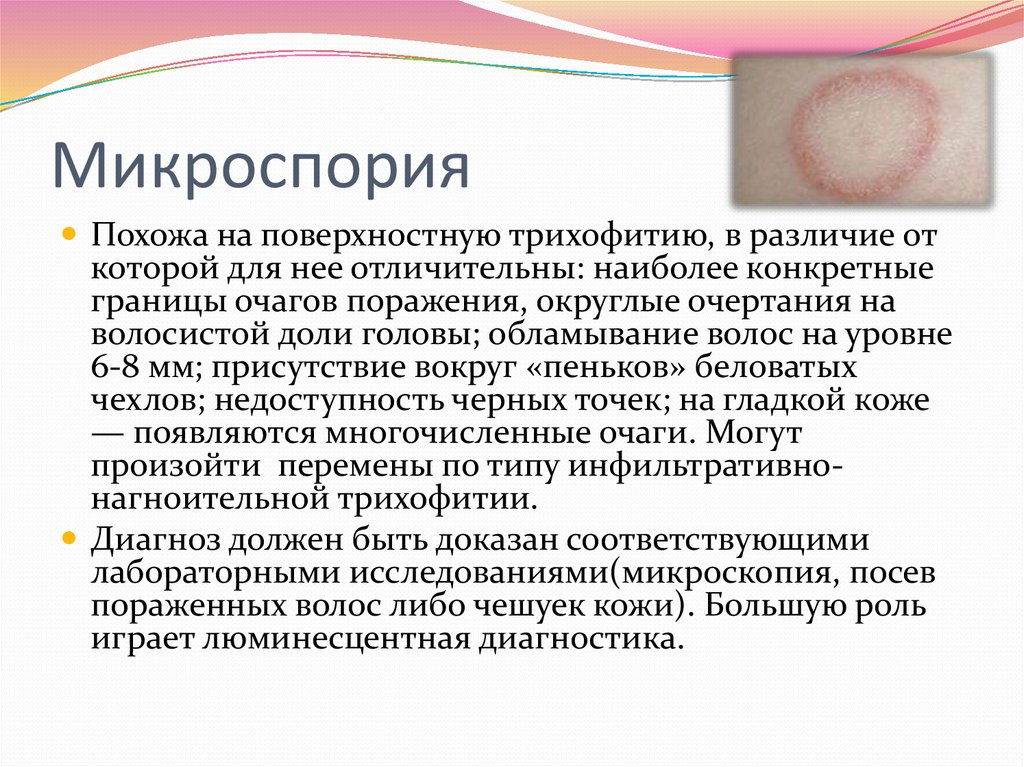 К грибковым заболеваниям кожи относятся. Трихофития кожное заболевание что такое.