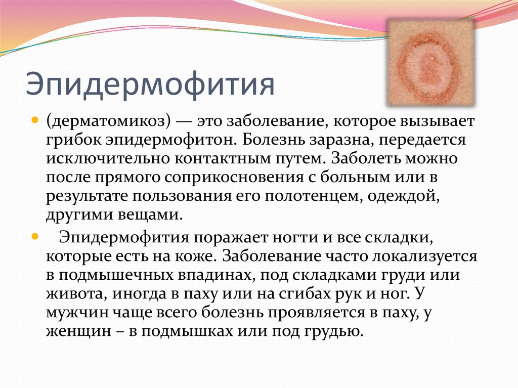 К грибковым заболеваниям кожи относятся. Грибковые заболевания эпидермофитий. Кожные заболевания эпидермофития. Инфекционные заболевания кожи. Грибковые заболевания кожи.