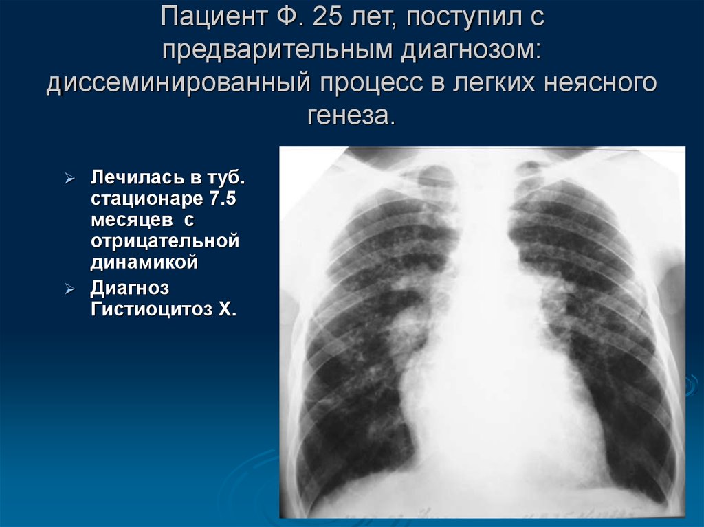 К т легких 10. Диссеминированный процесс в лёгких. Диссеминированных процессов в легких. Двусторонняя диссеминация легких.