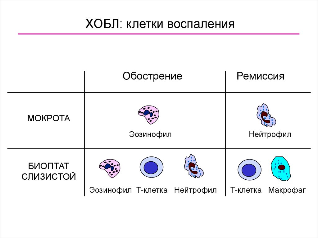 Клетки воспаления. Клетки воспаления ХОБЛ. Клетки медиаторы воспаление ХОБЛ.