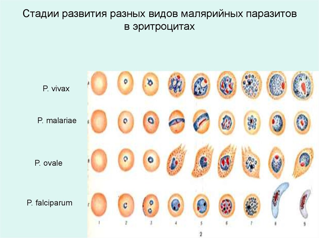 На разных стадиях развития. Стадии развития паразитов. Малярия стадии развития. Стадия развития малярийного паразита. Стадии развития малярийного плазмодия в эритроцитах.