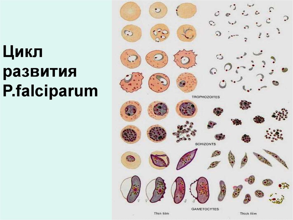 П развитие. Малярийный плазмодий falciparum. Малярийный плазмодий Plasmodium falciparum;. Plasmodium falciparum шизонт. Plasmodium falciparum трофозоит.