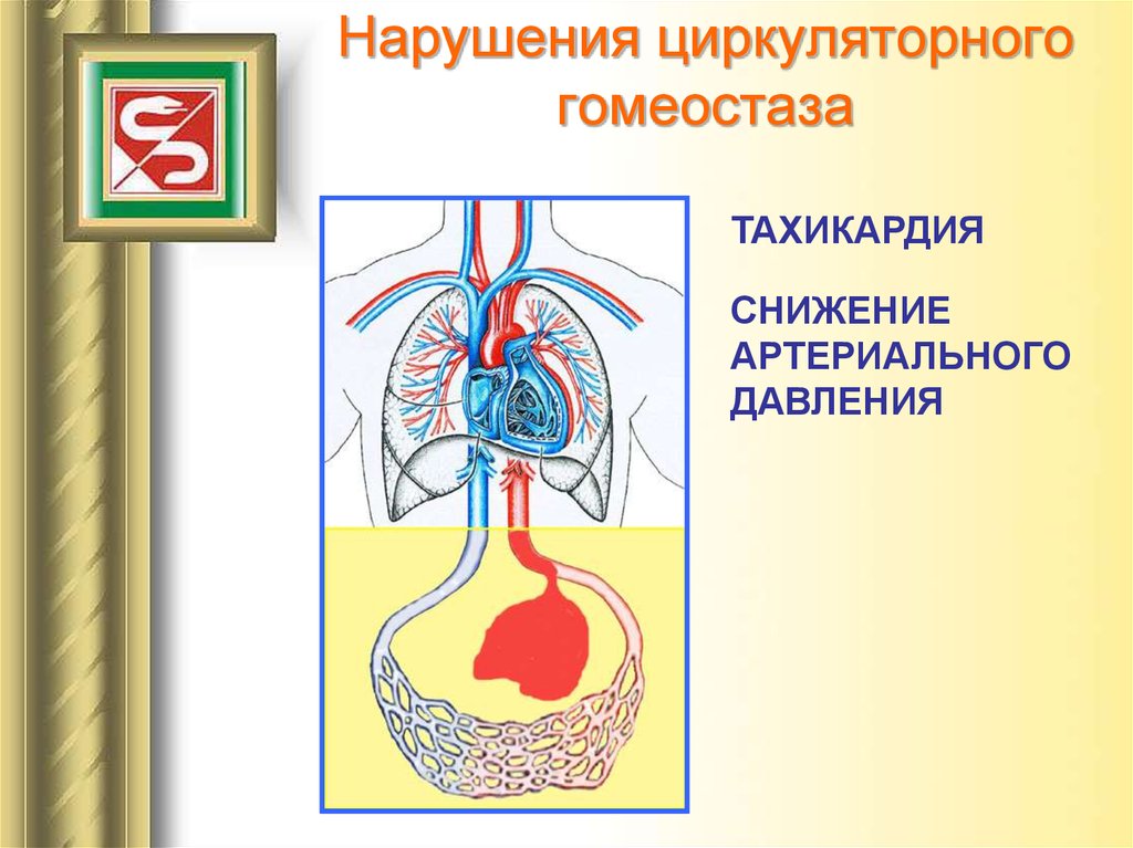 Нарушения циркуляторного гомеостаза