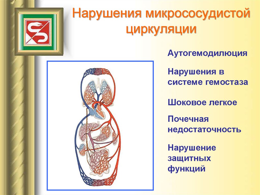Нарушения микрососудистой циркуляции