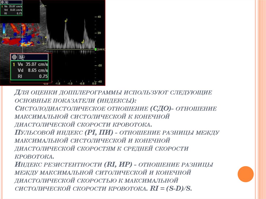 Диастолическое и систолическое разница 60. Показатели допплерограммы. Показатели долперограммы. Демпфированность» допплерограммы это. Конечная диастолическая скорость.