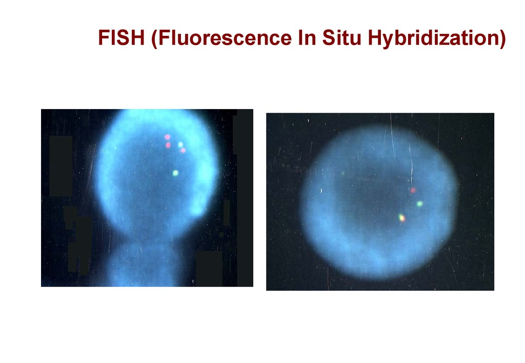 FISH (Fluorescence In Situ Hybridization)