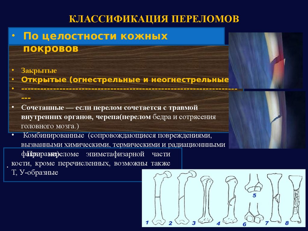 Реабилитация в травматологии и ортопедии презентация