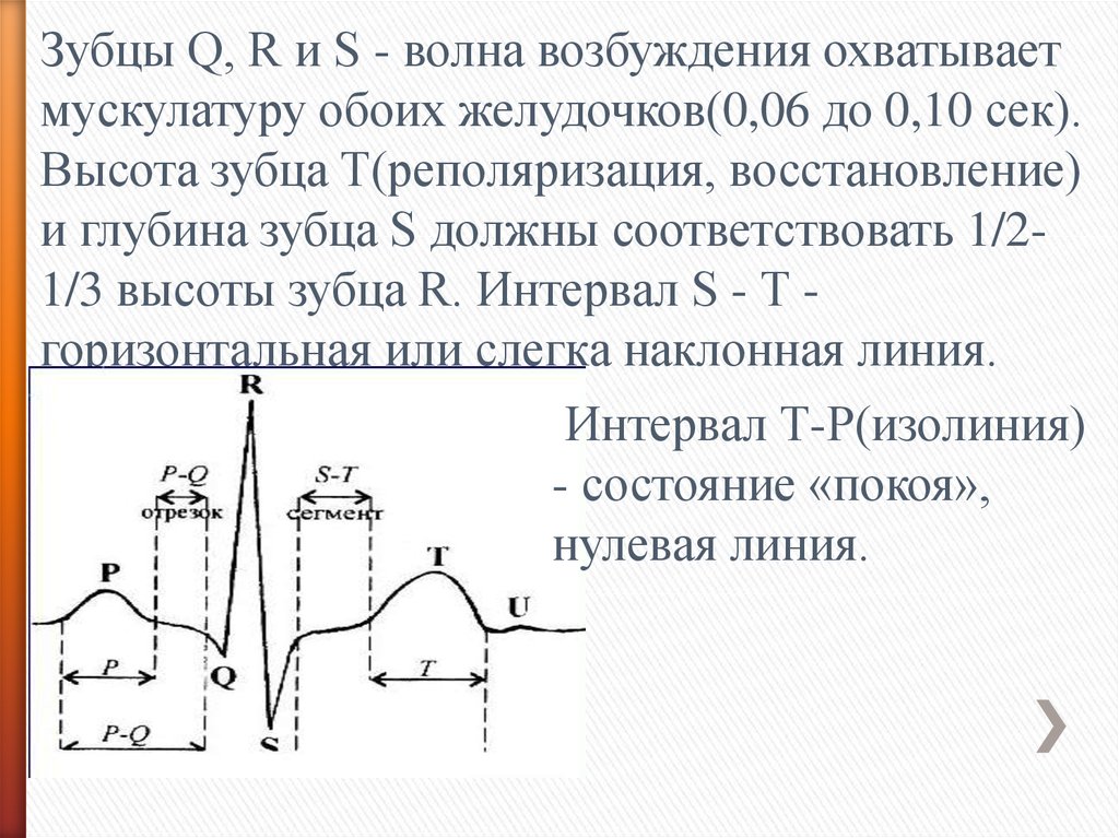 Волна возбуждения. Высота зубца q. Высота зубца т. Анализ волны возбуждения. Глубина зубца q.