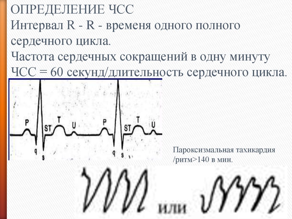 Как измерить частоту сердечных. ЧСС. Частота сердечных сокращений. Определение частоты сердечных сокращений. Определите частоту сокращения сердца.