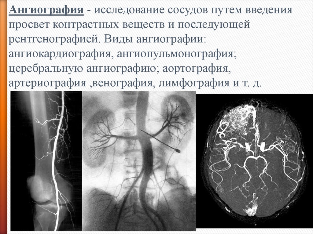 Сосудистые исследования. Ангиографическое исследование сосудов. Контрастное исследование сосудов. Ангиография Введение контрастного вещества. Ангиография пропедевтика.