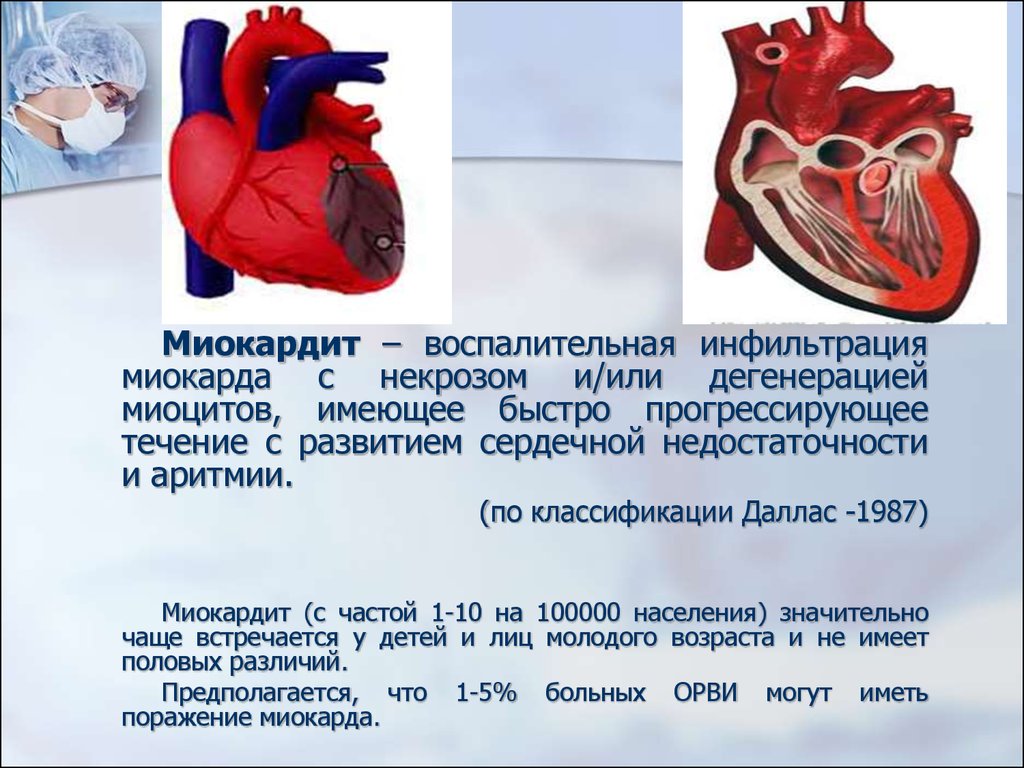 Миокардит лечение у женщин