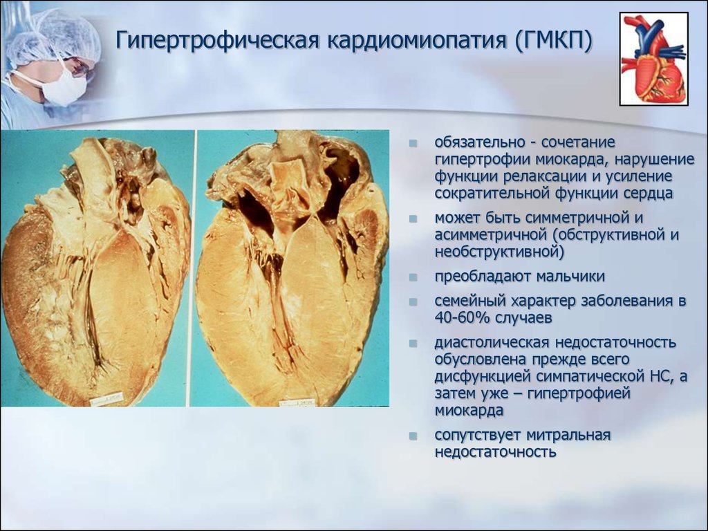 Кардиомиопатии у детей презентация