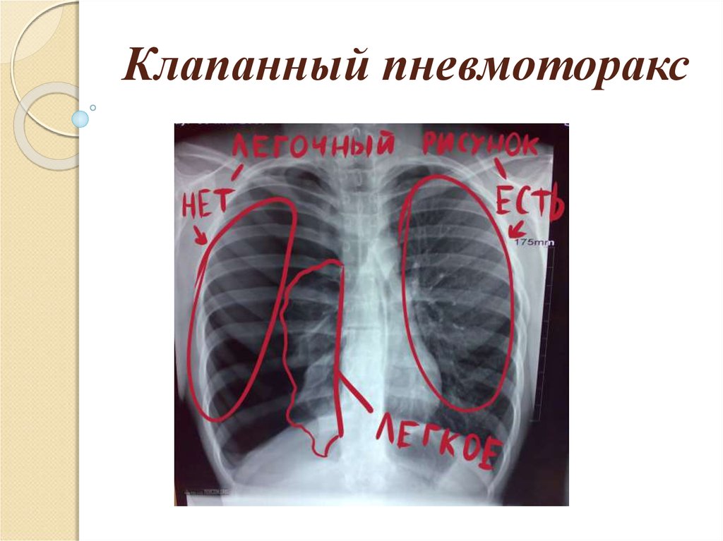 К метательным легкоатлетическим снарядам относятся ядро мяч копье бита диск граната ответ