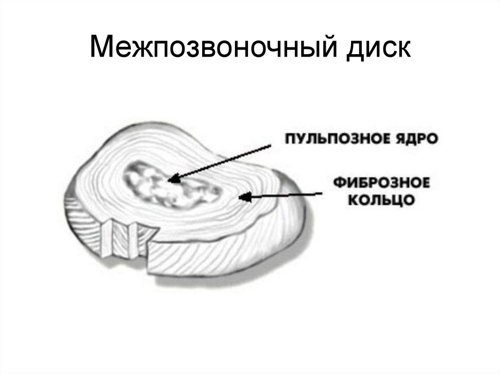 Содержимое межпозвоночного диска. Схема строения межпозвонкового диска. Строение межпозвонкового диска рисунок. Пульпозное ядро и фиброзное кольцо. Межпозвоночный диск фиброзное кольцо и студенистое ядро.