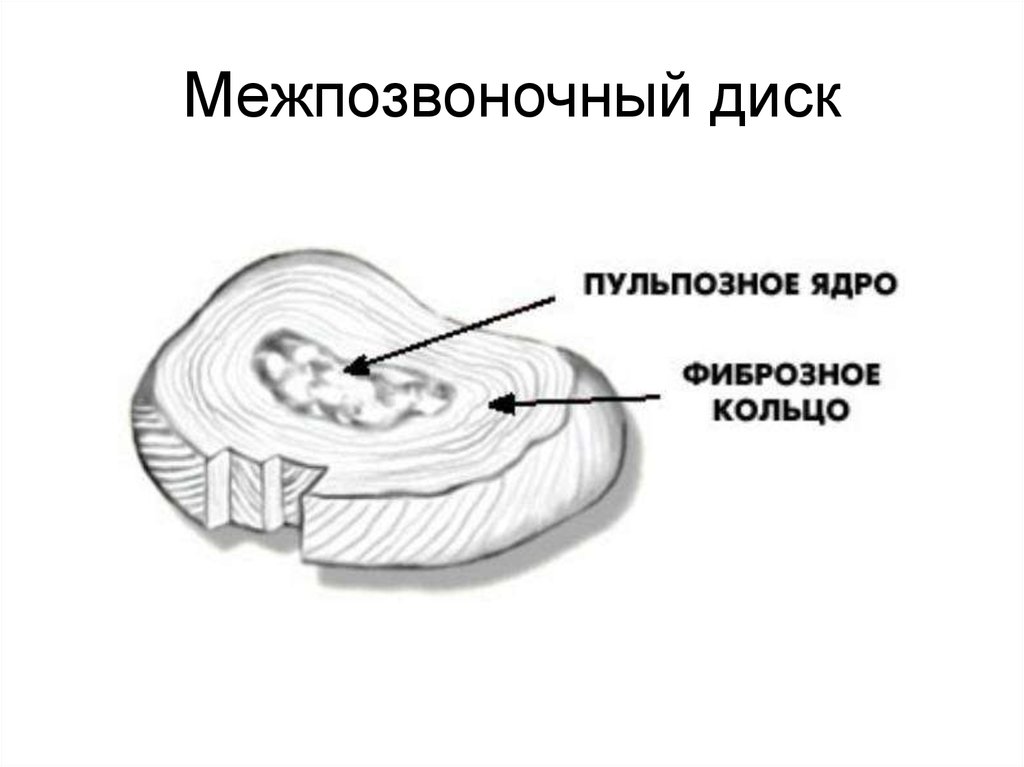 Восстанавливается ли межпозвоночный диск после операции