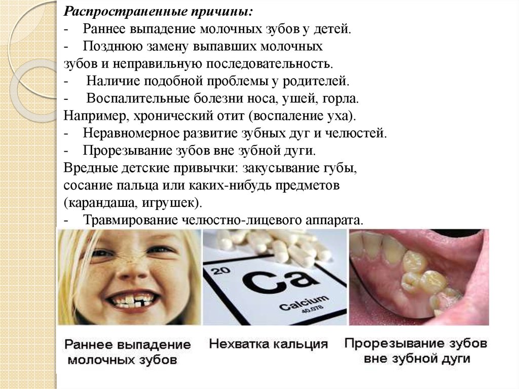 Молочная пятерка зуб. Молочные зубы у детей. Выпадение молочных зубов. Выпадают молочные зубы у ребенка.