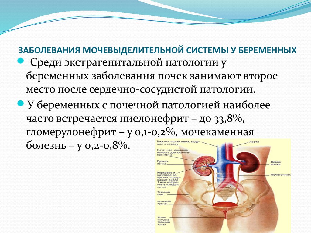 Презентация по теме заболевания мочевыделительной системы