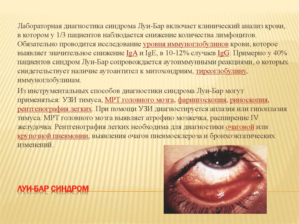 ЛУИ-БАР синдром