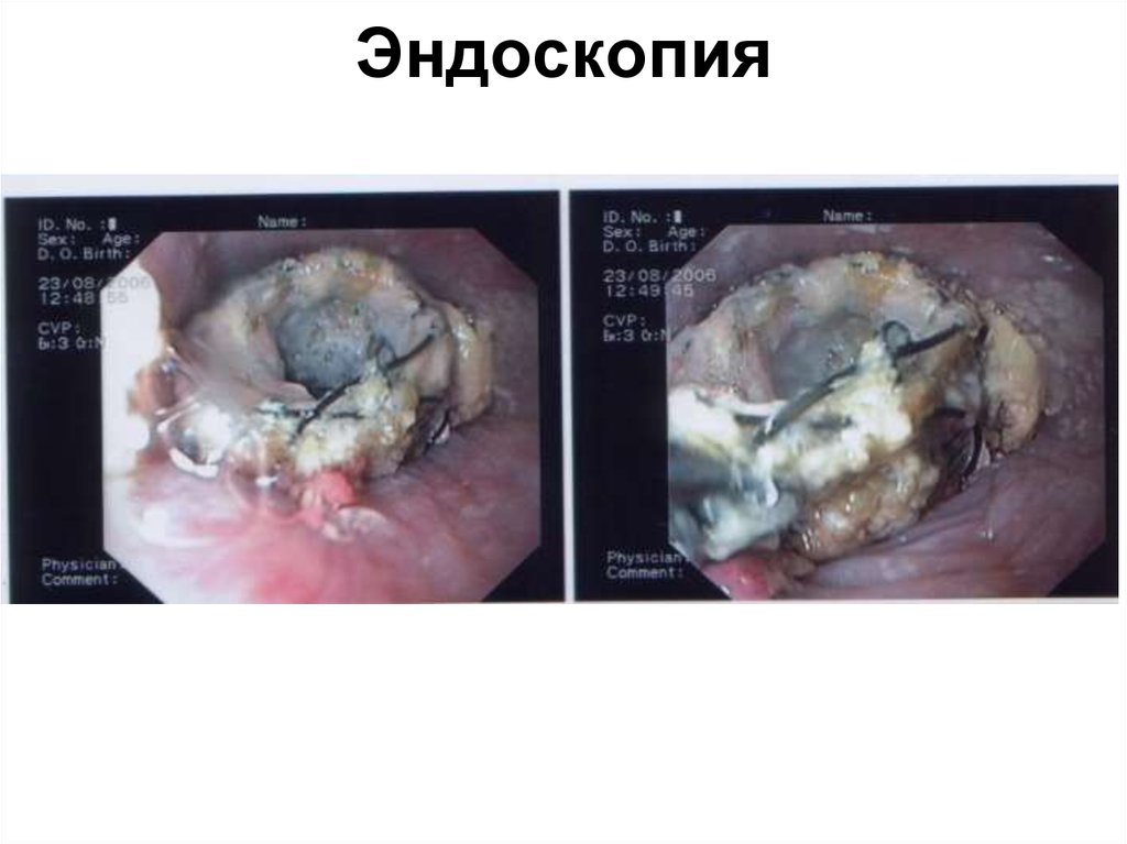 Эндоскопия