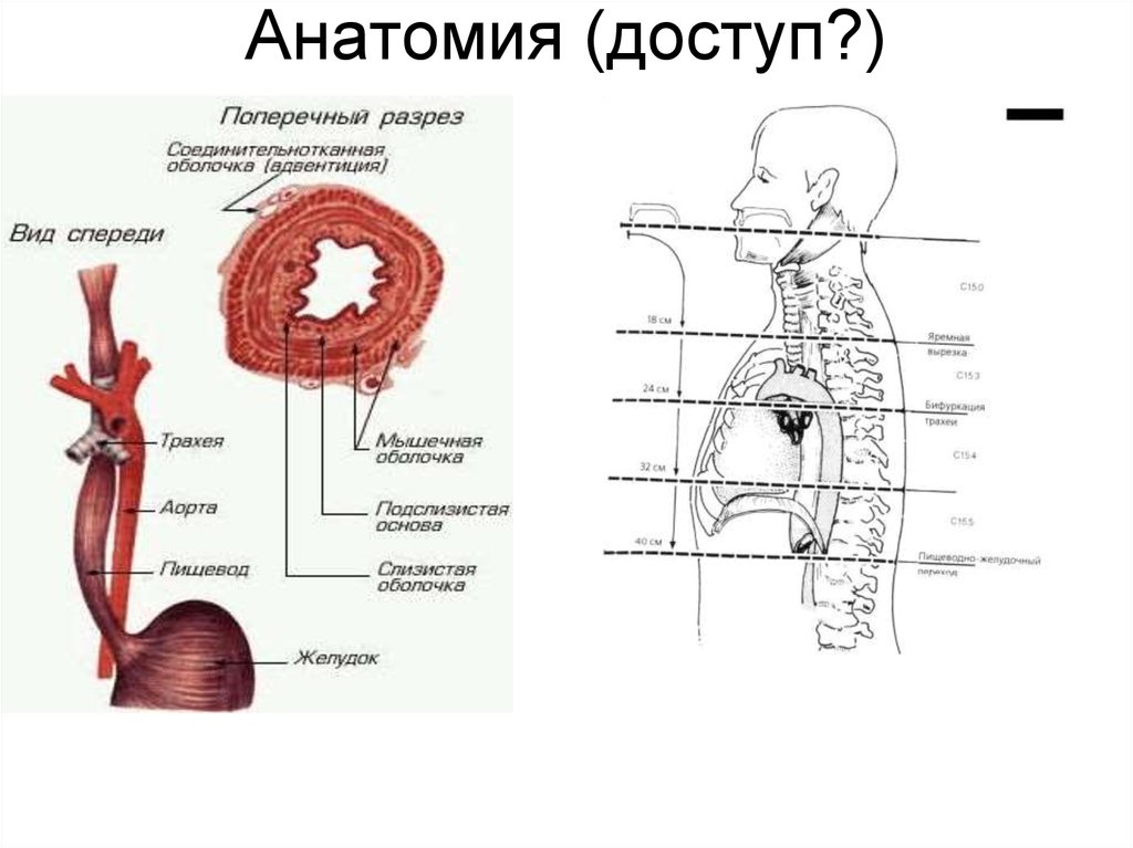 Травмы пищевода презентация