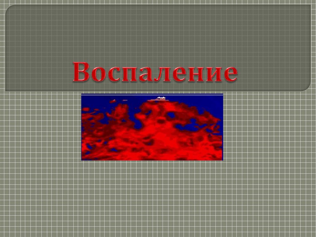 Воспаление картинки для презентации. Признаки воспаления схема. Симптомы воспалительного процесса. Признаки воспаления схема. Воспаление жар.