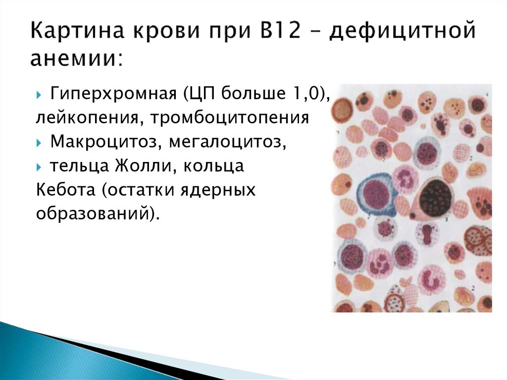 Картина крови при анемии