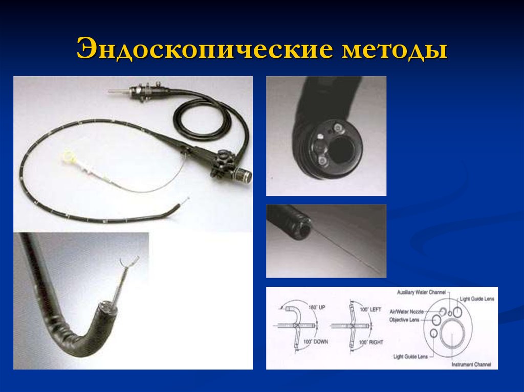 Эндоскопические методы исследования презентация