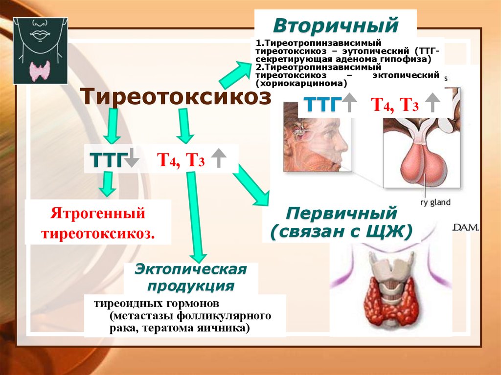 Заболевание при избытке гормона щитовидной железы. Гипертиреоз первичный и вторичный. Первичный тиреотоксикоз. Тиреотоксикоз ТТГ. ТТГ- секретирующая опухоль гипофиза.