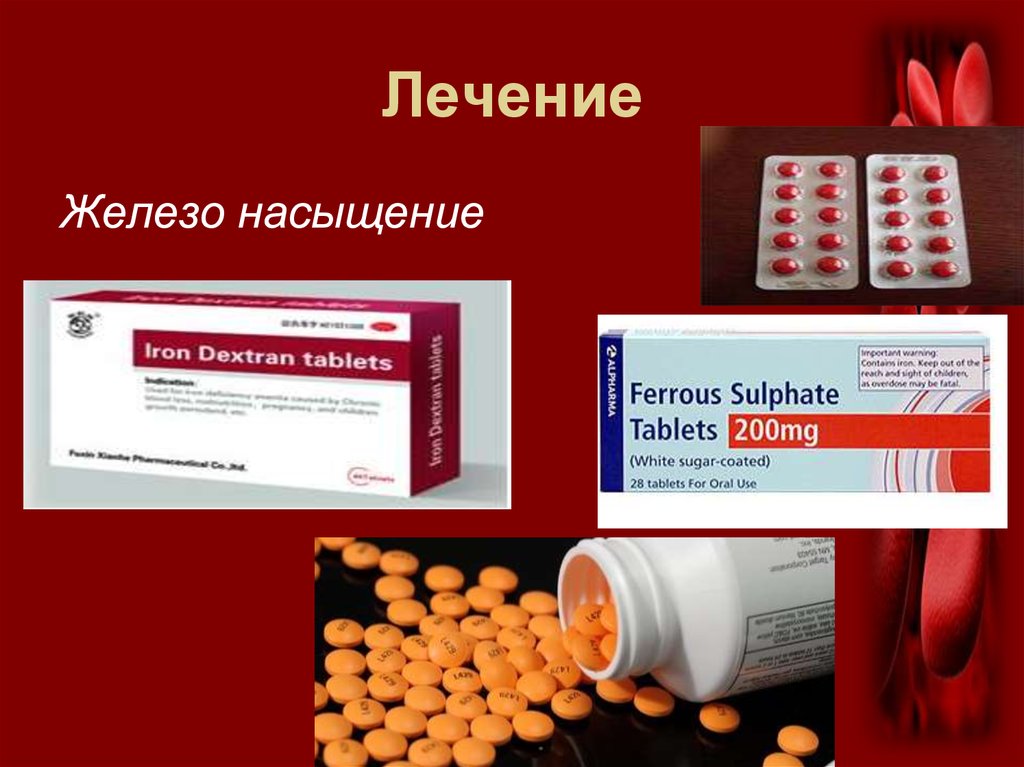 железо для беременных. препараты 2 валентного железа при анемии. лечебное железо. лечебное железо. терапия препаратами железа при железодефицитной анемии.