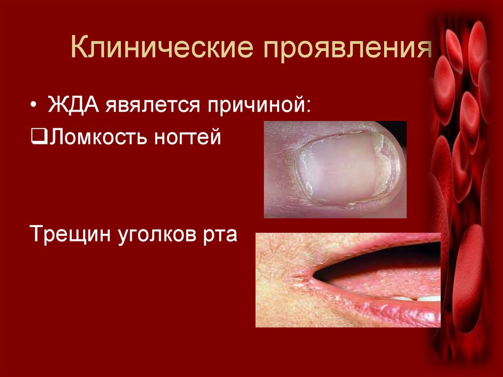 Клинические проявления