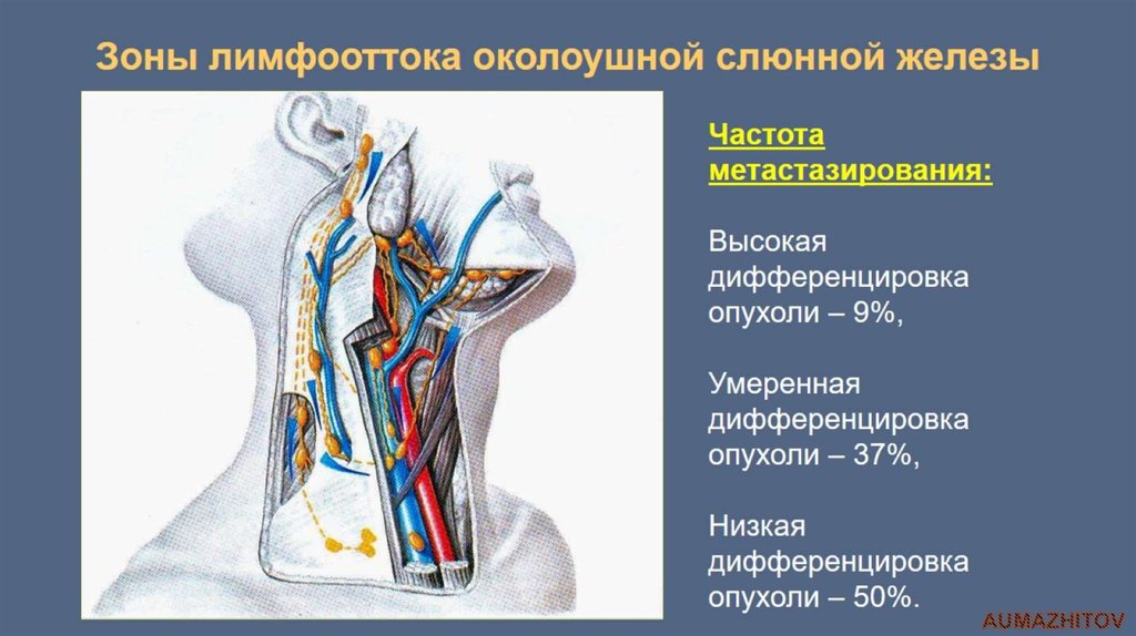 Операции околоушной железы. Околоушные лимфоузлы анатомия. Слюнные железы лимфоотток. Лимфоузлы околоушной слюнной железы. Околоушная железа анатомия.