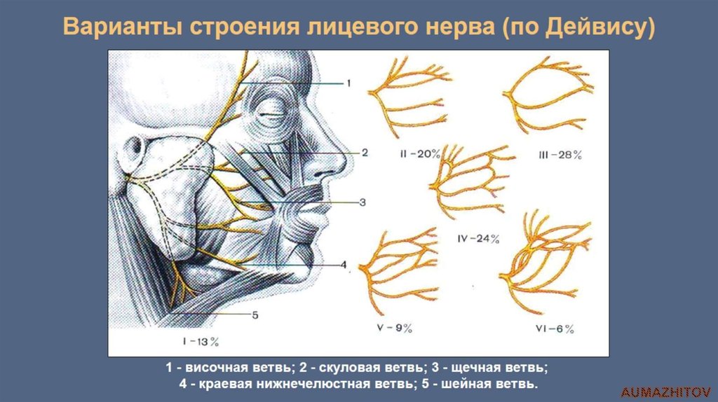 Лицевые нервы человека. Лицевой нерв анатомия ветви. Топография лицевого нерва топографическая анатомия. Височная ветвь лицевого нерва. Лицевой нерв анатомия топография ветви.