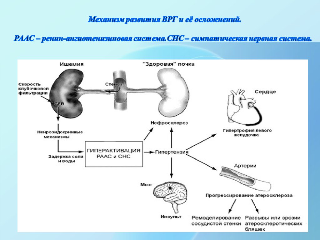 Механизм развития системы. Система РААС при артериальной гипертензии. Механизм развития осложнения это. Гиперактивация РААС. СНС И РААС.