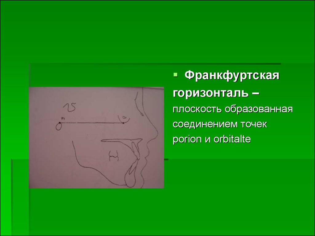 Горизонтали соединяют. Франкфуртская горизонталь. Крамфурская горизонталь. Камперовская плоскость и франкфуртская горизонталь. Франкфуртская горизонталь проводится через точки.