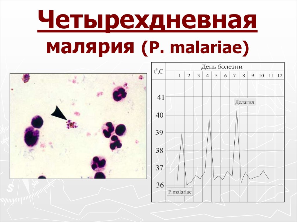 Характерный признак малярии