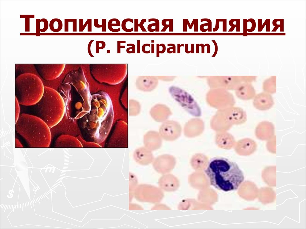 Лечение тяжелой тропической малярии. Малярийный плазмодий Тропическая малярия. Plasmodium falciparum трехдневная малярия. Малярийный плазмодий Plasmodium falciparum;. Малярийный плазмодий это бактерия.