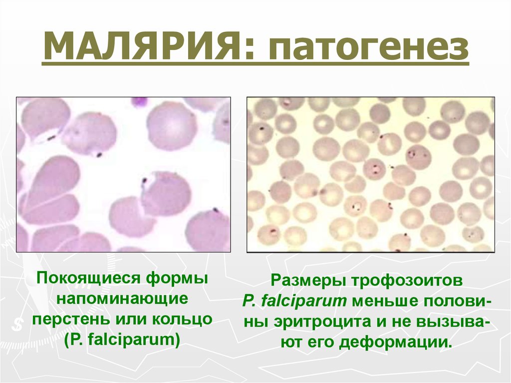 Малярия в домашних условиях. Малярия этиология. Патогенез малярии. Формы малярии.