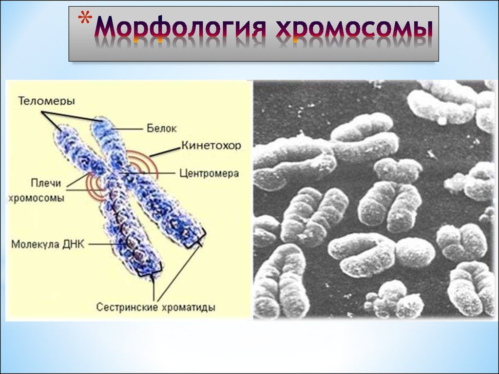 Хроматид в ядре. Строение хромосомы рисунок с подписями и функции. Строение хромосомы рисунок. Хроматин хроматиды хромосомы. Строение клетки хромосомы.