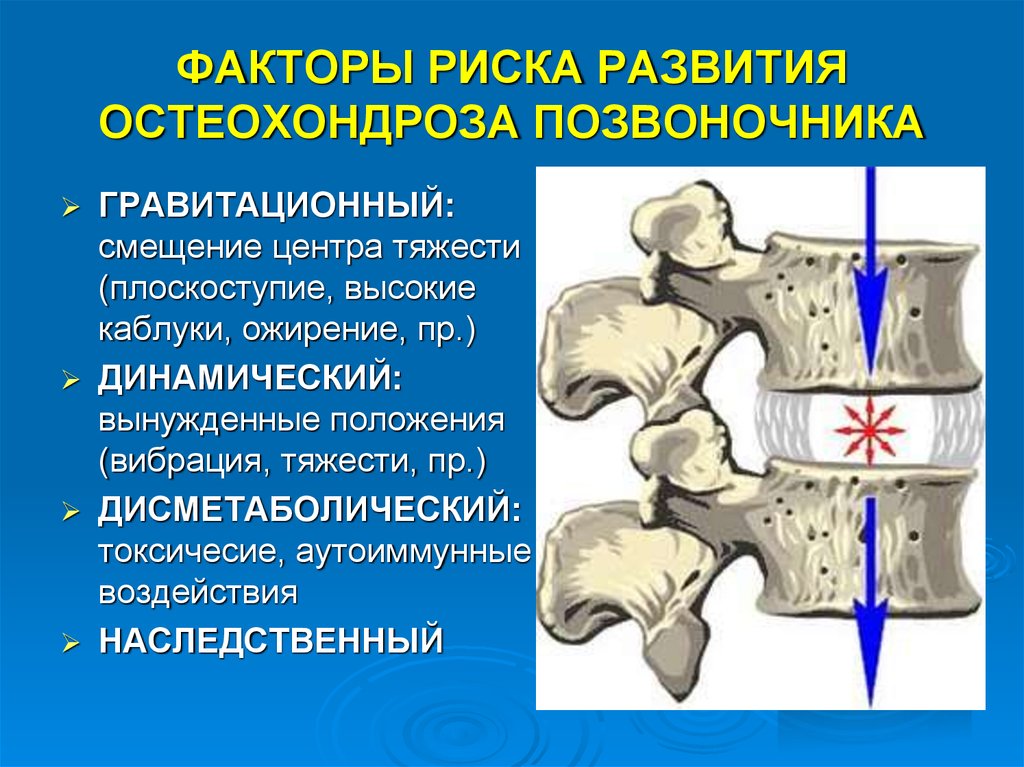 Факторы остеохондроза. Факторы риска остеохондроза. Факторы риска остеохондроза позвоночника. Факторы риска развития остеохондроза. Факторы риска остеозрнлроз.