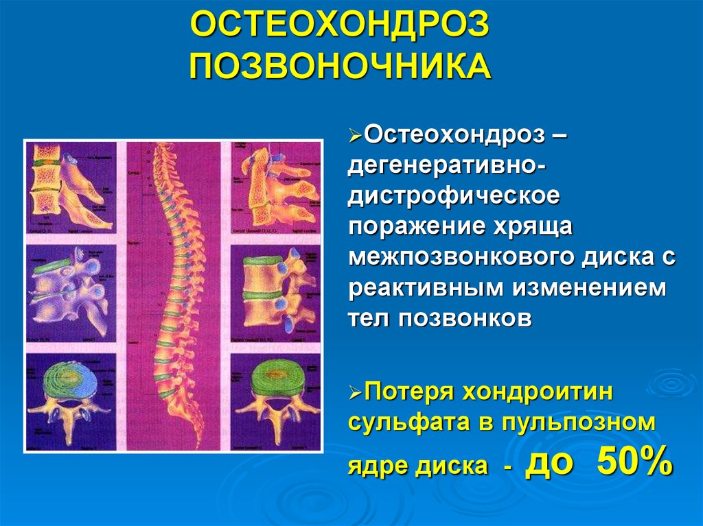 Противовоспалительные для позвоночника