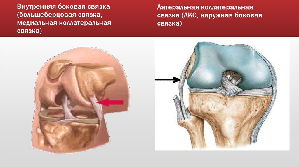 Разрыв латеральной связки