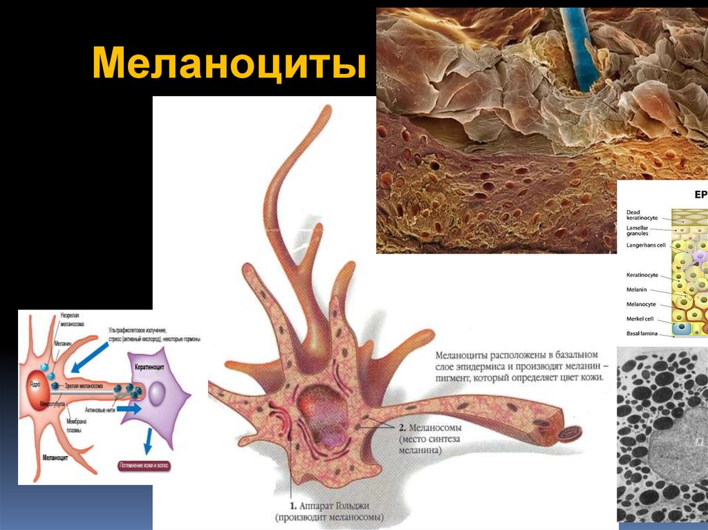 Меланин в коже человека защищает от. Меланоциты строение гистология. Меланосомы и меланоциты. Меланоциты клетки эпидермиса.